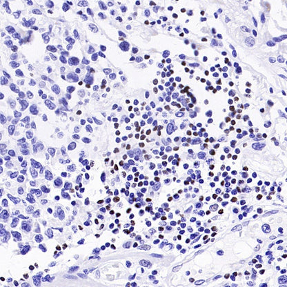TCF1/TCF7 Recombinant Rabbit mAb (S-3486)
