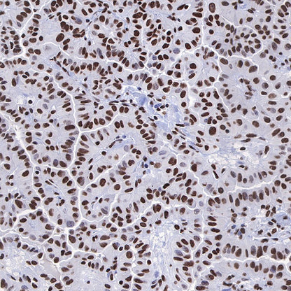 Histone H3 (acetyl K4 + K9 + K18) Rabbit polyclonal antibody