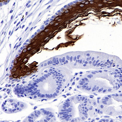 CK-13 Recombinant Rabbit mAb (SDT-641-41)