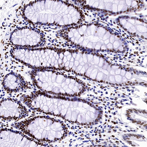 Phospho-Histone H3 (Ser28) Recombinant Rabbit mAb (S-1025-45)