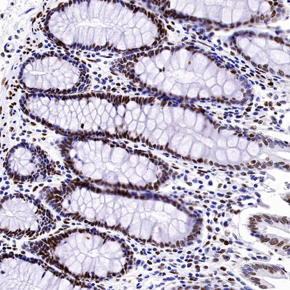 Phospho-Histone H3 (Ser28) Recombinant Rabbit mAb (S-1025-45)