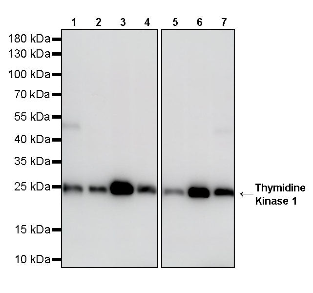 Thymidine Kinase 1 Recombinant Rabbit mAb (S-4127-43)