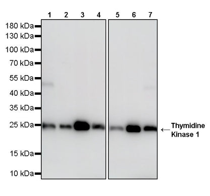 Thymidine Kinase 1 Recombinant Rabbit mAb (S-4127-43)
