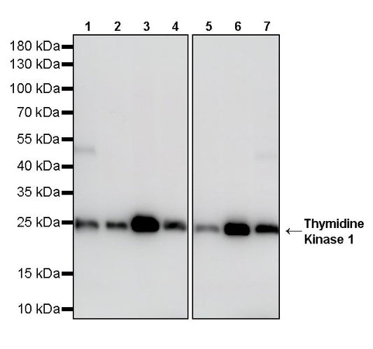 Thymidine Kinase 1 Recombinant Rabbit mAb (S-4127-43)