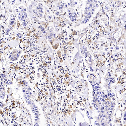 GBP5 Rabbit Polyclonal Antibody
