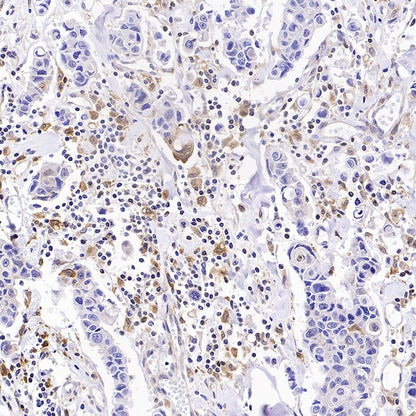 GBP5 Rabbit Polyclonal Antibody