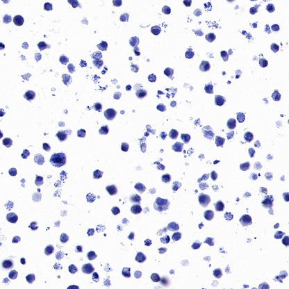 STEAP1+STEAP1B1+STEAP1B2 Recombinant Rabbit mAb (S-3226-137)