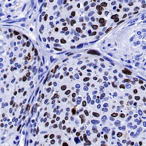 S-RMab® Ki67 Recombinant Rabbit mAb (SDT-R459)
