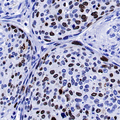 S-RMab® Ki67 Recombinant Rabbit mAb (SDT-R459)