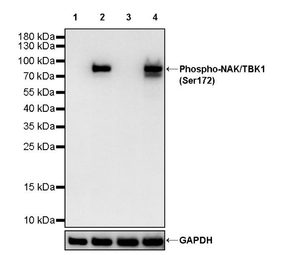 Phospho-NAK/TBK1 (Ser172) Recombinant Rabbit mAb (S-2481-14)