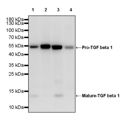 TGF beta 1 Recombinant Rabbit mAb (S-3204)