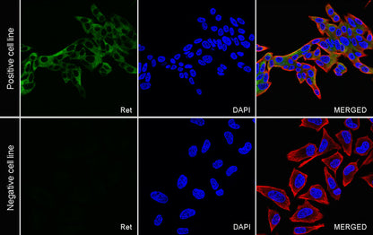 Ret Recombinant Rabbit mAb (S-5298)