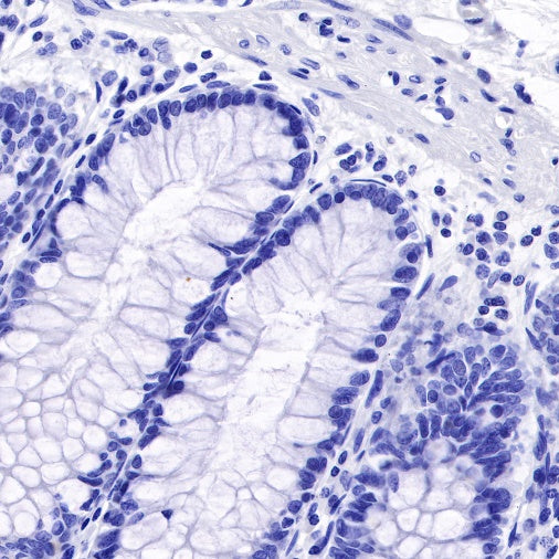 S-RMab®SALL4 Recombinant Rabbit mAb (SDT-R232)