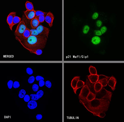 p21 Waf1/Cip1 Recombinant Rabbit mAb (SDT-1349-71)