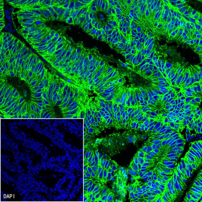 S-RMab® EpCAM Recombinant Rabbit mAb(SDT-078-13)