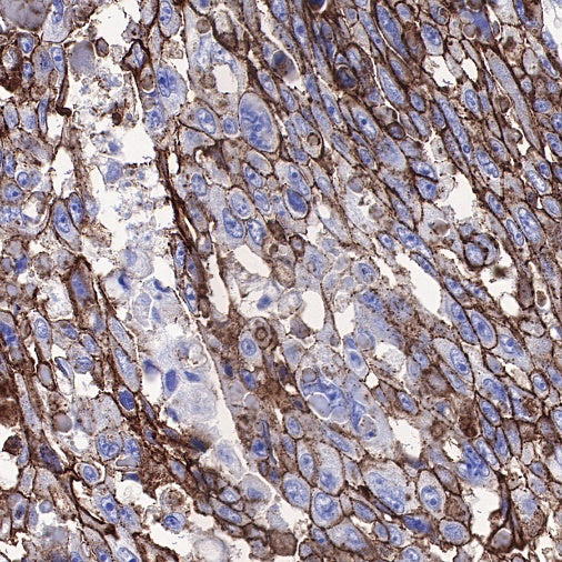 Carbonic Anhydrase 9 Recombinant Rabbit mAb (SDT-733-28)