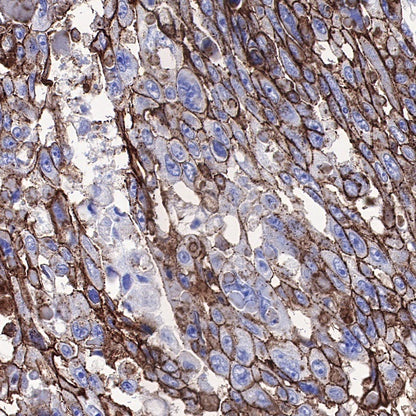 Carbonic Anhydrase 9 Recombinant Rabbit mAb (SDT-733-28)