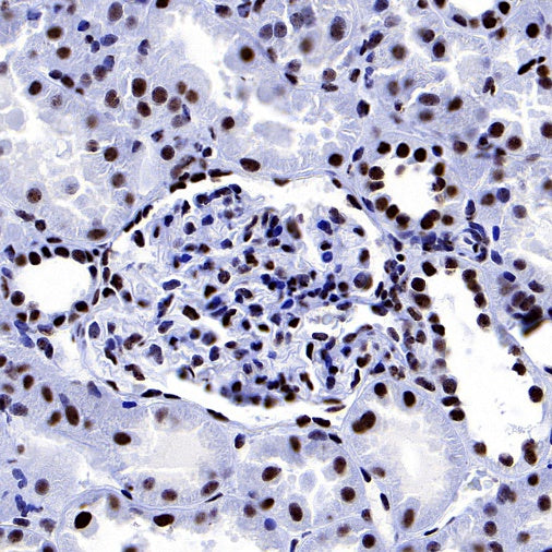 PELP1 Recombinant Rabbit mAb (S-756-22)