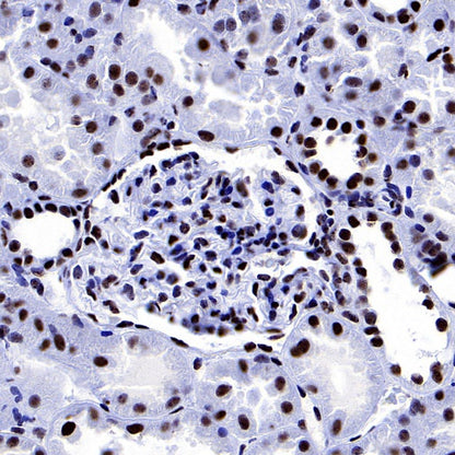 PELP1 Recombinant Rabbit mAb (S-756-22)