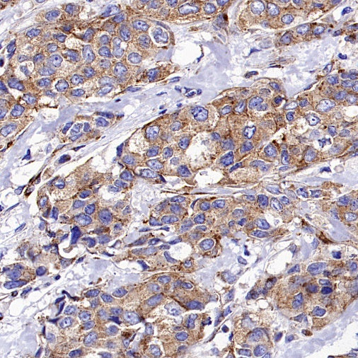 M6PR Recombinant Rabbit mAb (S-1480-21)