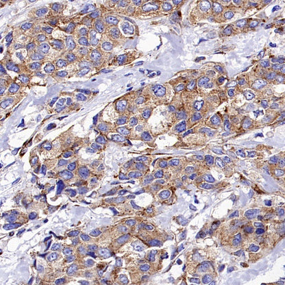M6PR Recombinant Rabbit mAb (S-1480-21)
