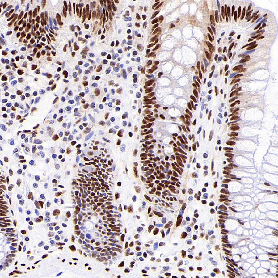 JUND Recombinant Rabbit mAb (S-4270-48)