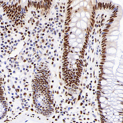 JUND Recombinant Rabbit mAb (S-4270-48)