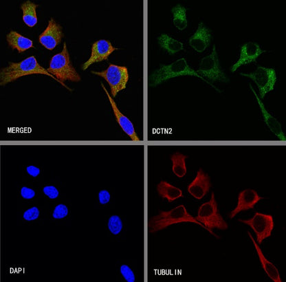 DCTN2 Recombinant Rabbit mAb (S-1082-7)