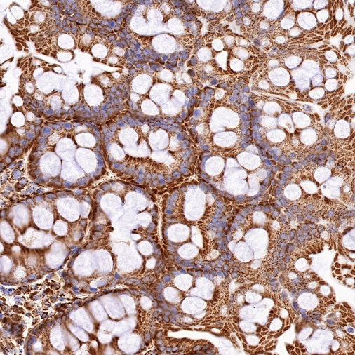 PBR/TSPO Recombinant Rabbit mAb (S-607-19)