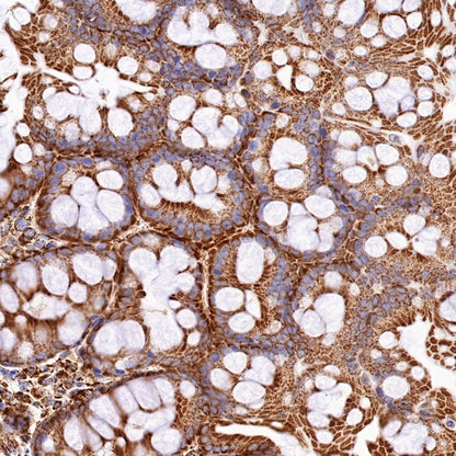 PBR/TSPO Recombinant Rabbit mAb (S-607-19)