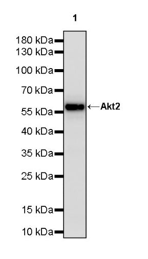 AKT2 Recombinant Rabbit mAb (S-3256)