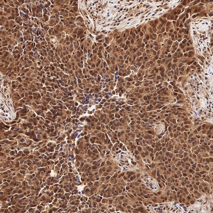 RBX1 Recombinant Rabbit mAb (S-R355)