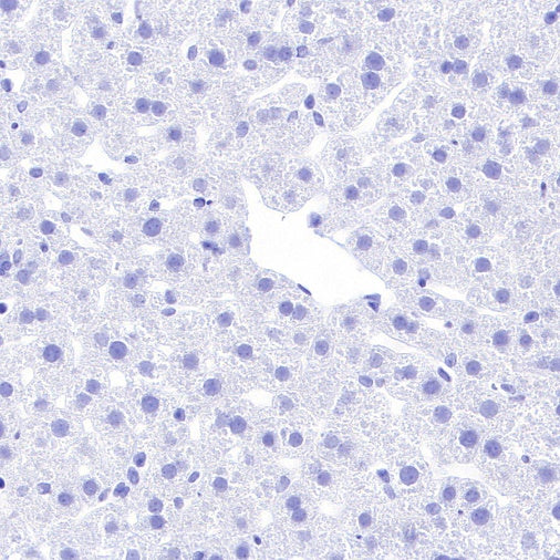 Pan Trk Recombinant Rabbit mAb (SDT-400-39)