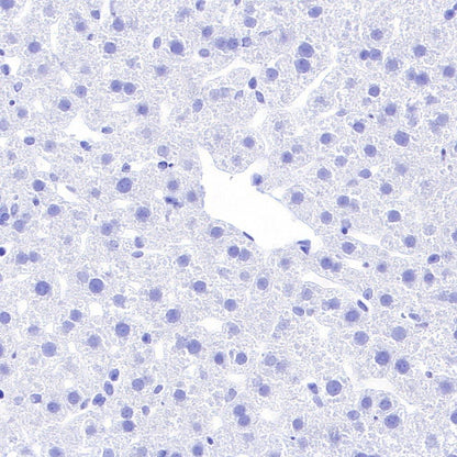 Pan Trk Recombinant Rabbit mAb (SDT-400-39)