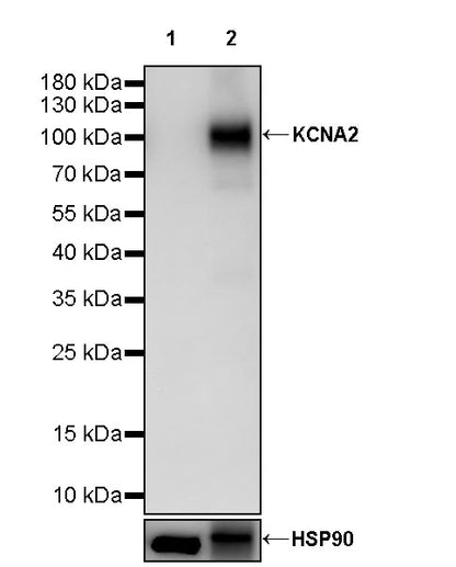 KCNA2 Recombinant Rabbit mAb (S-3939-53)