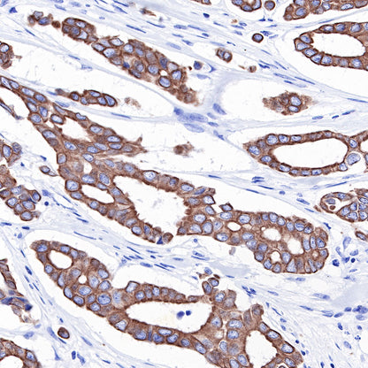 Keratin 18 Recombinant Rabbit mAb (SDT-R081)