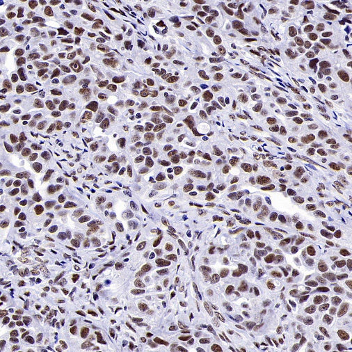 CDK9 Recombinant Rabbit mAb (S-2661-10)