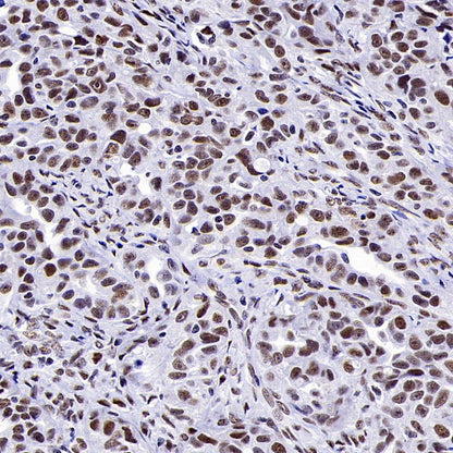 CDK9 Recombinant Rabbit mAb (S-2661-10)