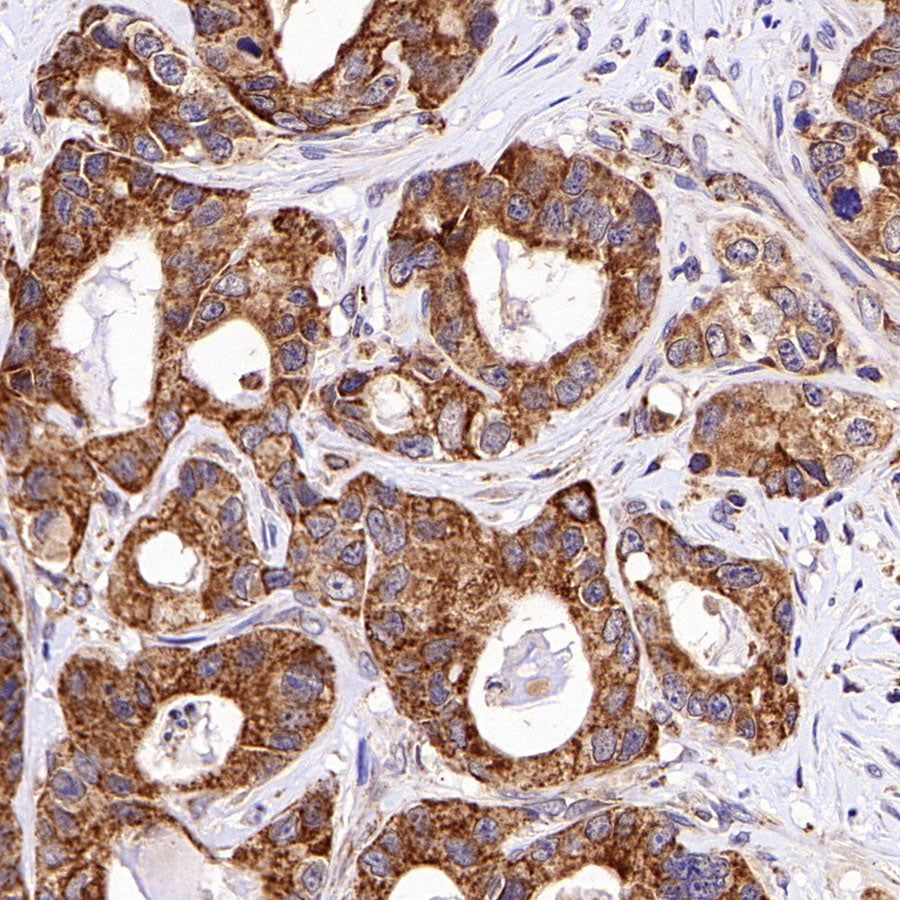 KCNMA1 Recombinant Rabbit mAb (S-2926-33)