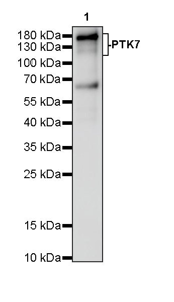 PTK7 Recombinant Rabbit mAb (SDT-2432-156)