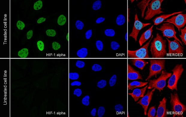 HIF-1α Recombinant Rabbit mAb (S-3123)