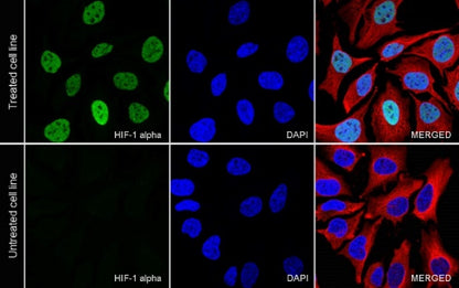 HIF-1α Recombinant Rabbit mAb (S-3123)