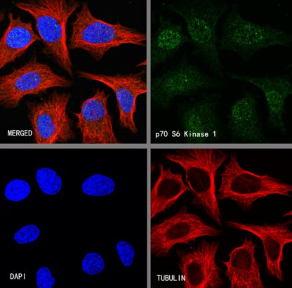 p70 S6 Kinase Recombinant Rabbit mAb (S-1278-2)