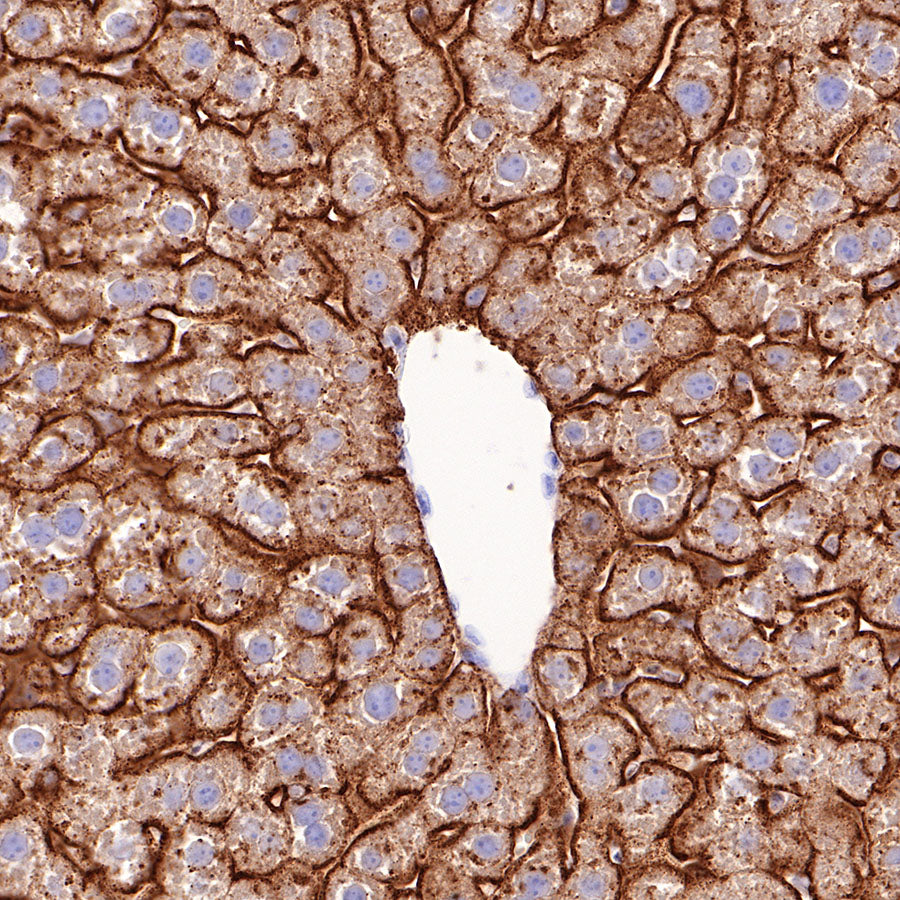 Asialoglycoprotein Receptor 1 Recombinant Rabbit mAb (SDT-292-48)