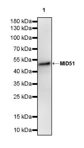 MID51 Recombinant Rabbit mAb (S-3570-28)