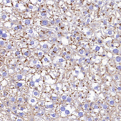Niemann Pick C1 Recombinant Rabbit mAb (S-5243)