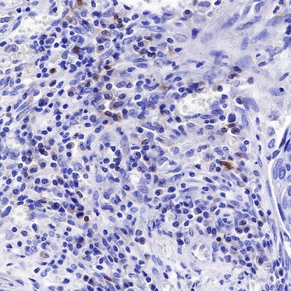 CD25/IL-2Rα Recombinant Rabbit mAb (S-R223)