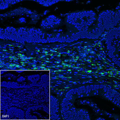 CD38 Mouse mAb (S-690-29)
