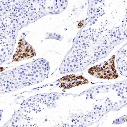 CYP11A1 Rabbit Polyclonal Antibody