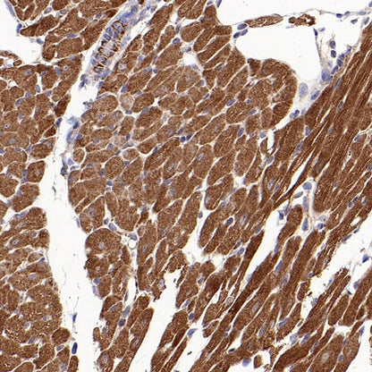 Mitofusin 2 Recombinant Rabbit mAb (S-1783-49)